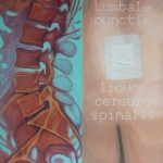 Look (at) inside me; Lumbale punctie, Liquor Cerebrospinalis Look (at) inside me; Lumbale punctie, Liquor Cerebrospinalis