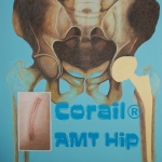 Look (at) inside me; Corail Look (at) inside me; Corail