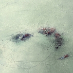 Abstract 4 15 Abstract 4 15