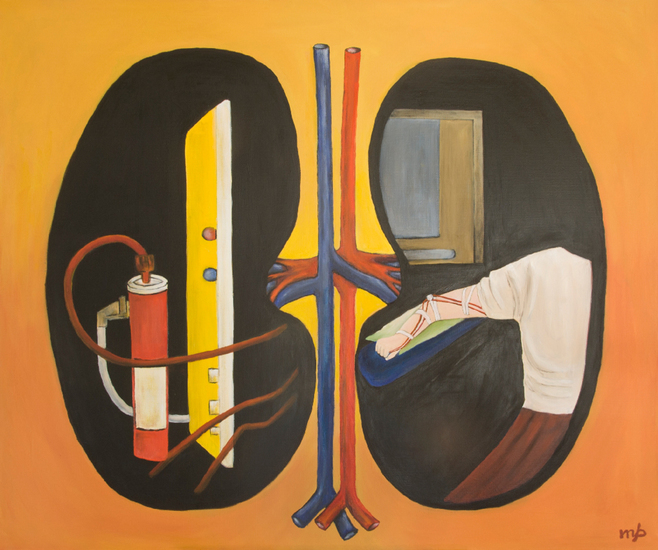 nierdialyse (opdracht)