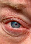 KUNST VOOR IEDER OOG. Foto's zijn onderdeel van een postercampagne voor het ODAPARK ,Centrum voor hedendaagse beeldende kunst, te Venray.