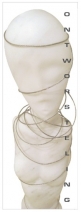 Ontworsteling op doek Ontworsteling op doek
