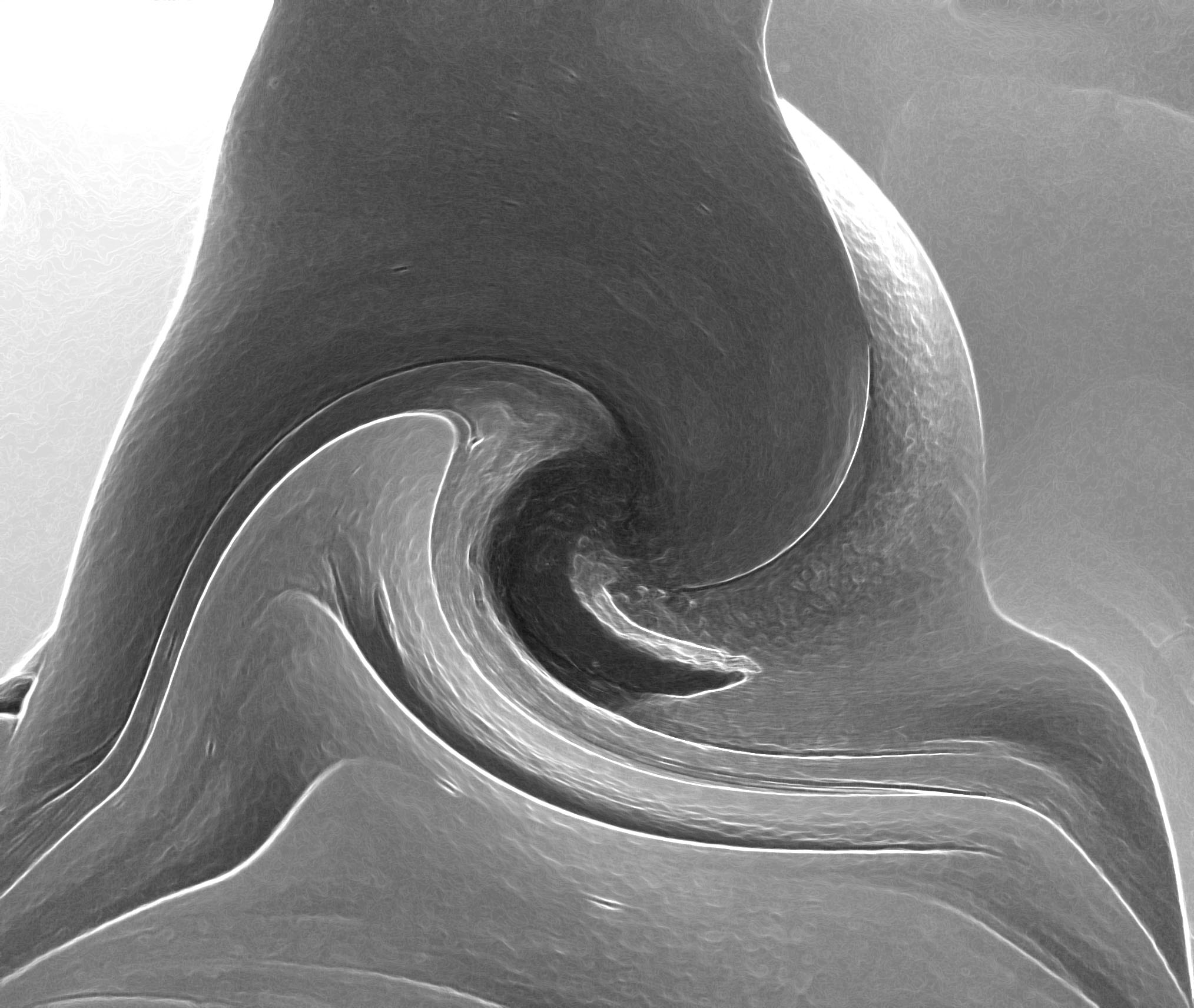 abstract 1