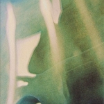 Schaduwbeeld. De brug