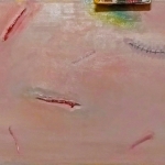 Pijn op gehavende huid