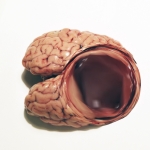 Brain
