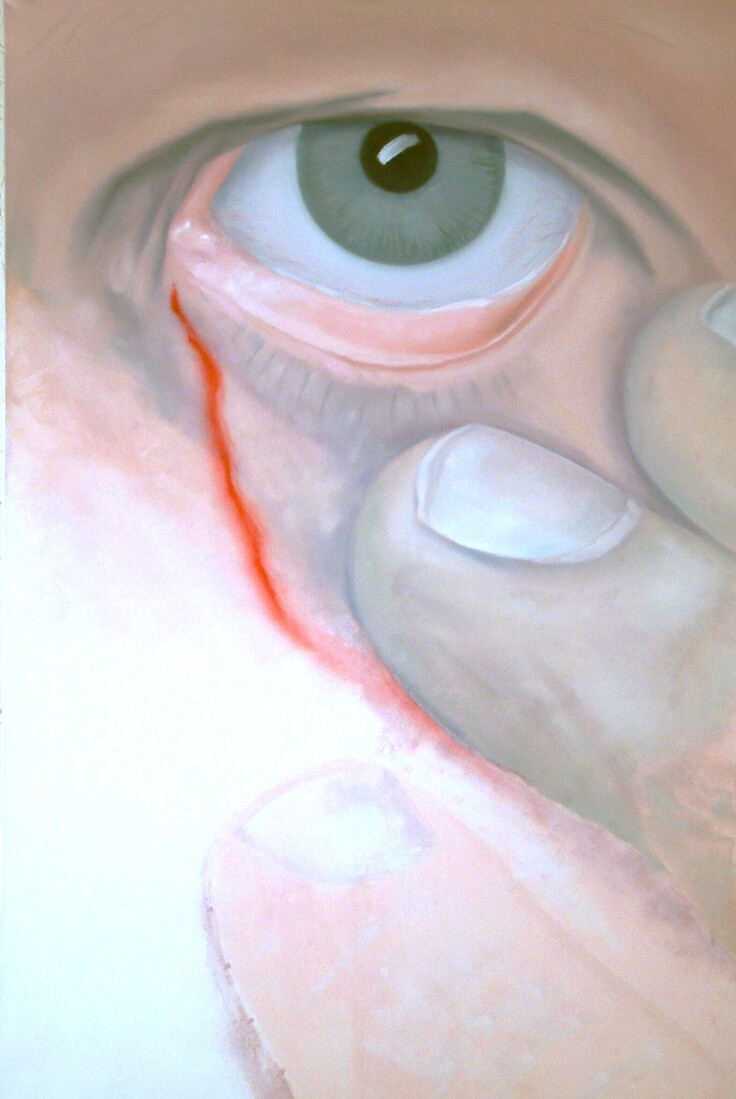 Ogen wijd open, pijnlijk