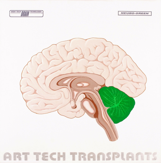 HTBT art tech Transplant: Neuro green