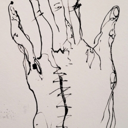 Scar