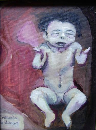 Cornelia de Lange syndroom