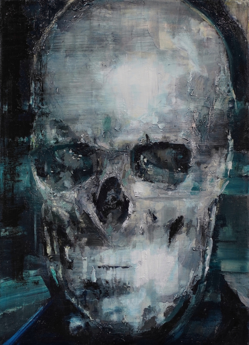 Mengele's skull