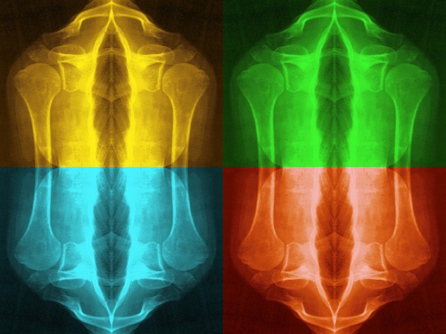 Skelet duo compilatie