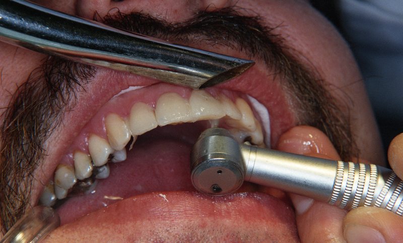 kleinbeeld kleur negatief