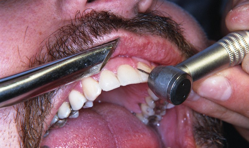 kleinbeeld kleur negatief