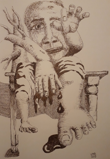Bloedende vinger