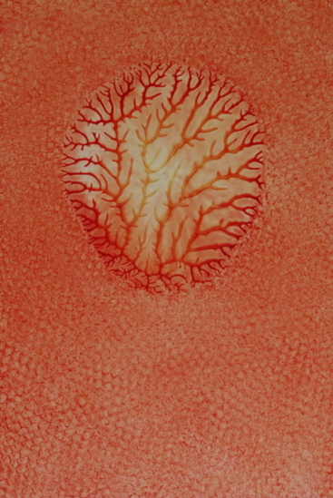 Grillig koraal