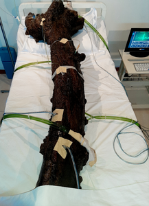 This is a hospital bed in which Camilio laid a tree trunk of 180cm long, which is roughly his high. The tree is connected to a heart monitor, water / oxygen and a drip. In this work we see a dead trunk in a bed, to focus on what we normally not see – the tree trunk represents deforestation, and the damages being inflicted to the environment as a whole (and the global warming it is inflicting), but also the artist and his fears.