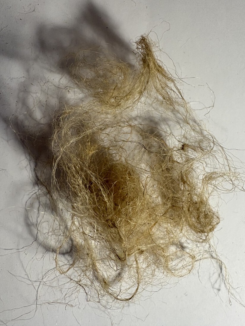 The rope