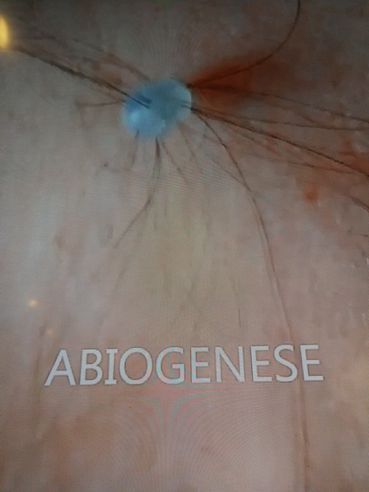 Abiogenese