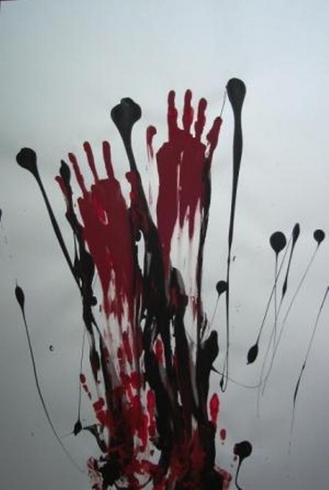 Bleeding 1