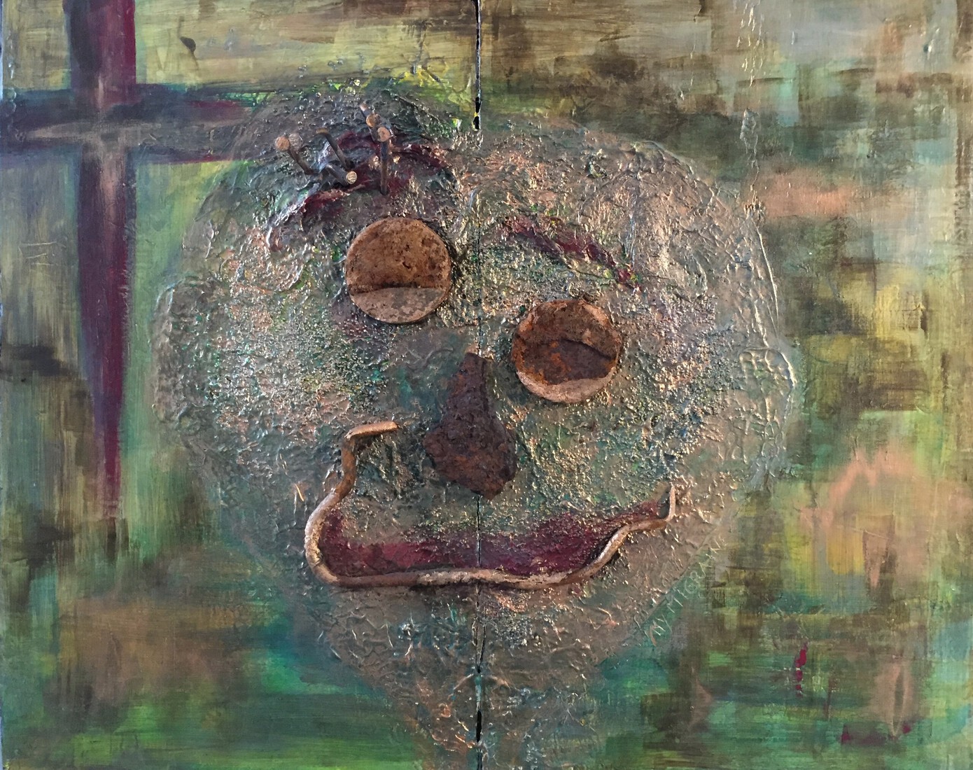 MyMigraine; Head nails