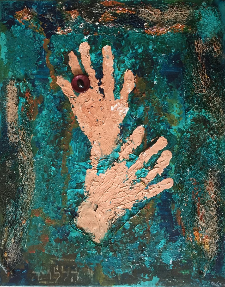 MyMigraine ; Lift up your hands