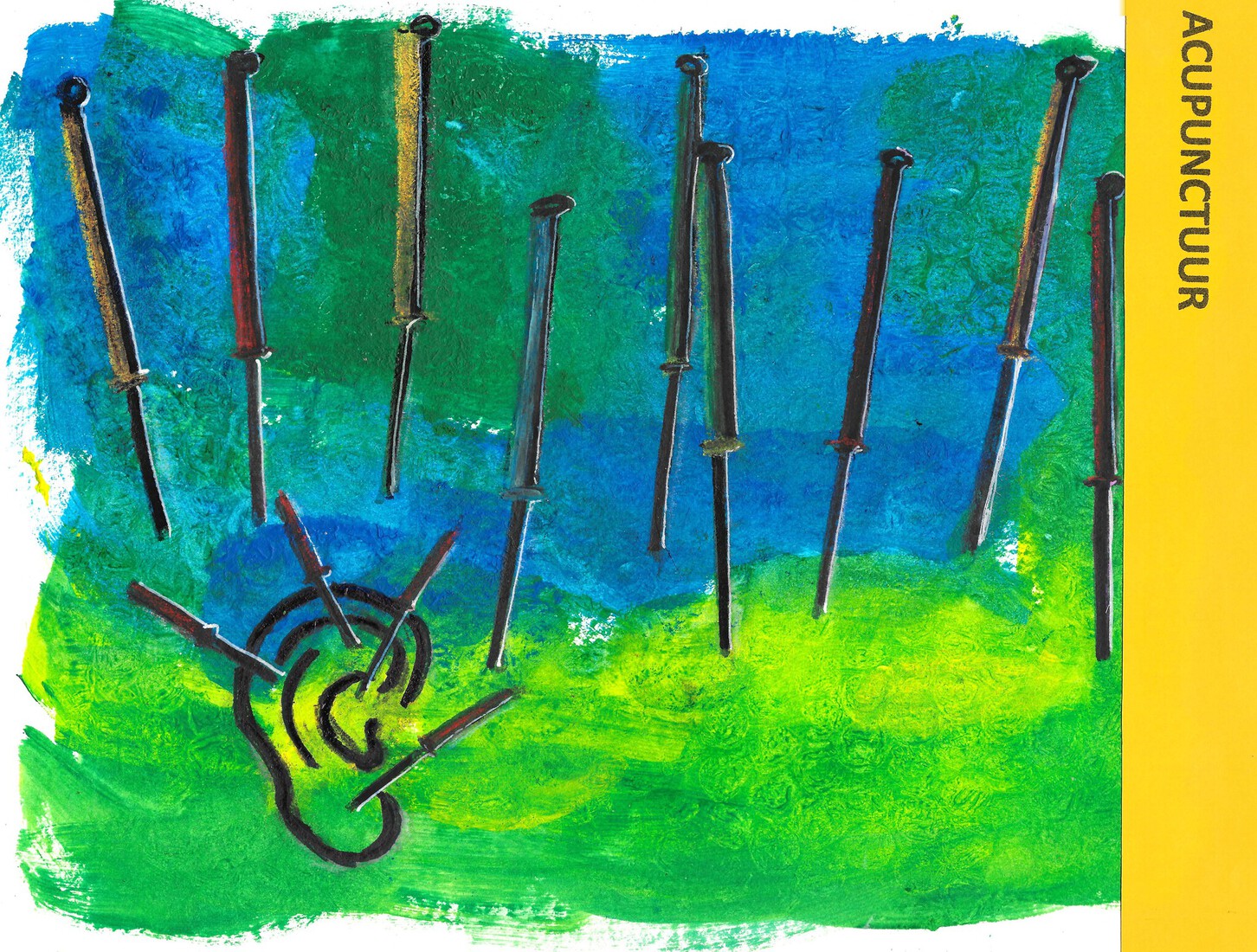 132 Behandeling: Acupunctuur