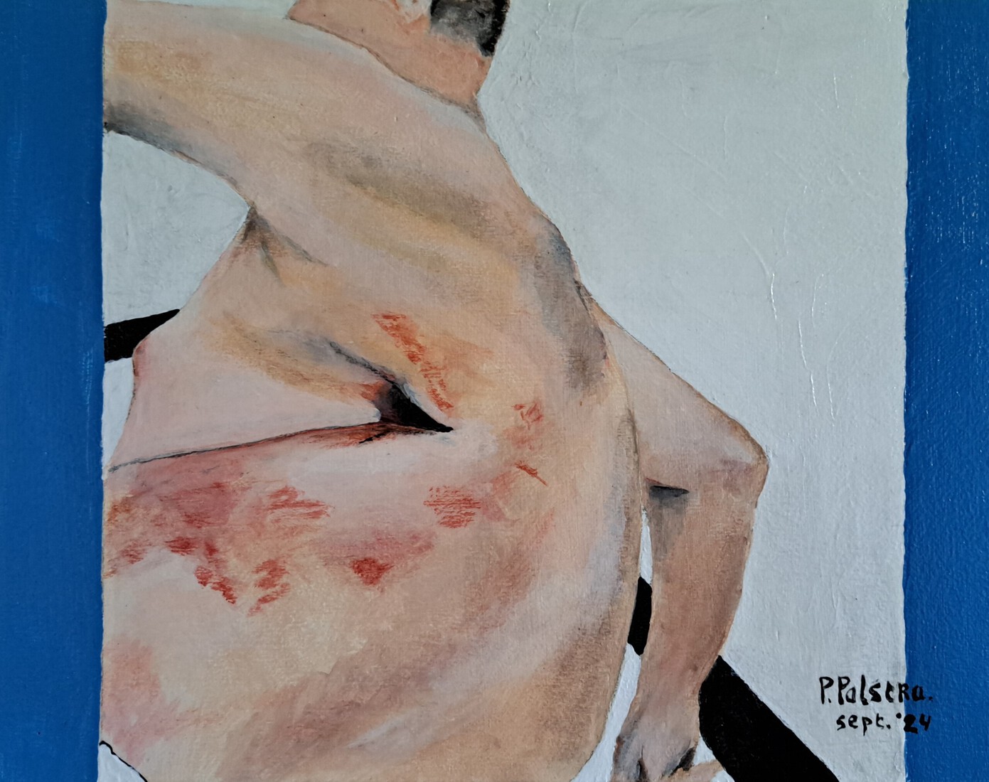 Rookalarm - Longverwijdering.